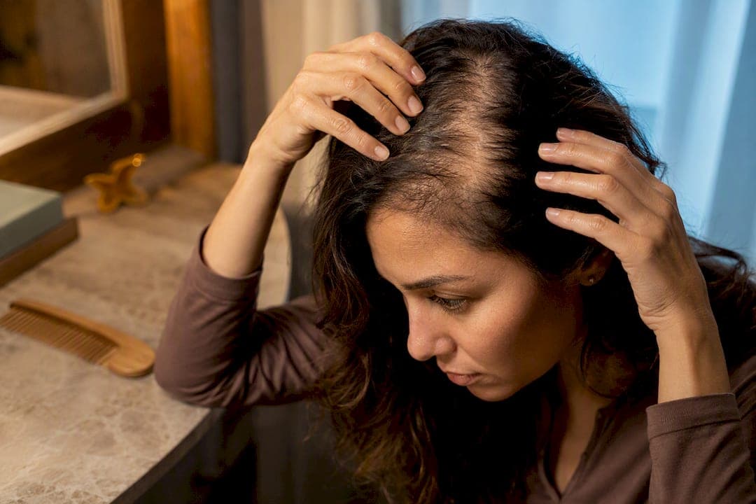 6–12 Month Recovery for Thyroid Hair Loss in Women