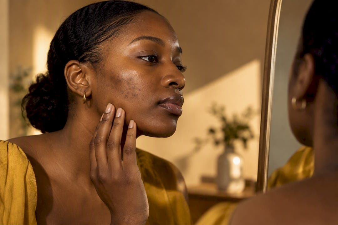 Fade Dark Spots in 8–12 Weeks: Skincare for Women of Color